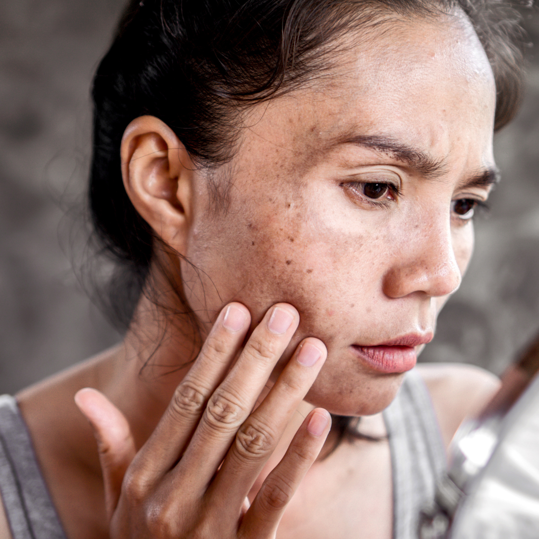 Rutina de Skincare para Piel con Manchas (Noche)