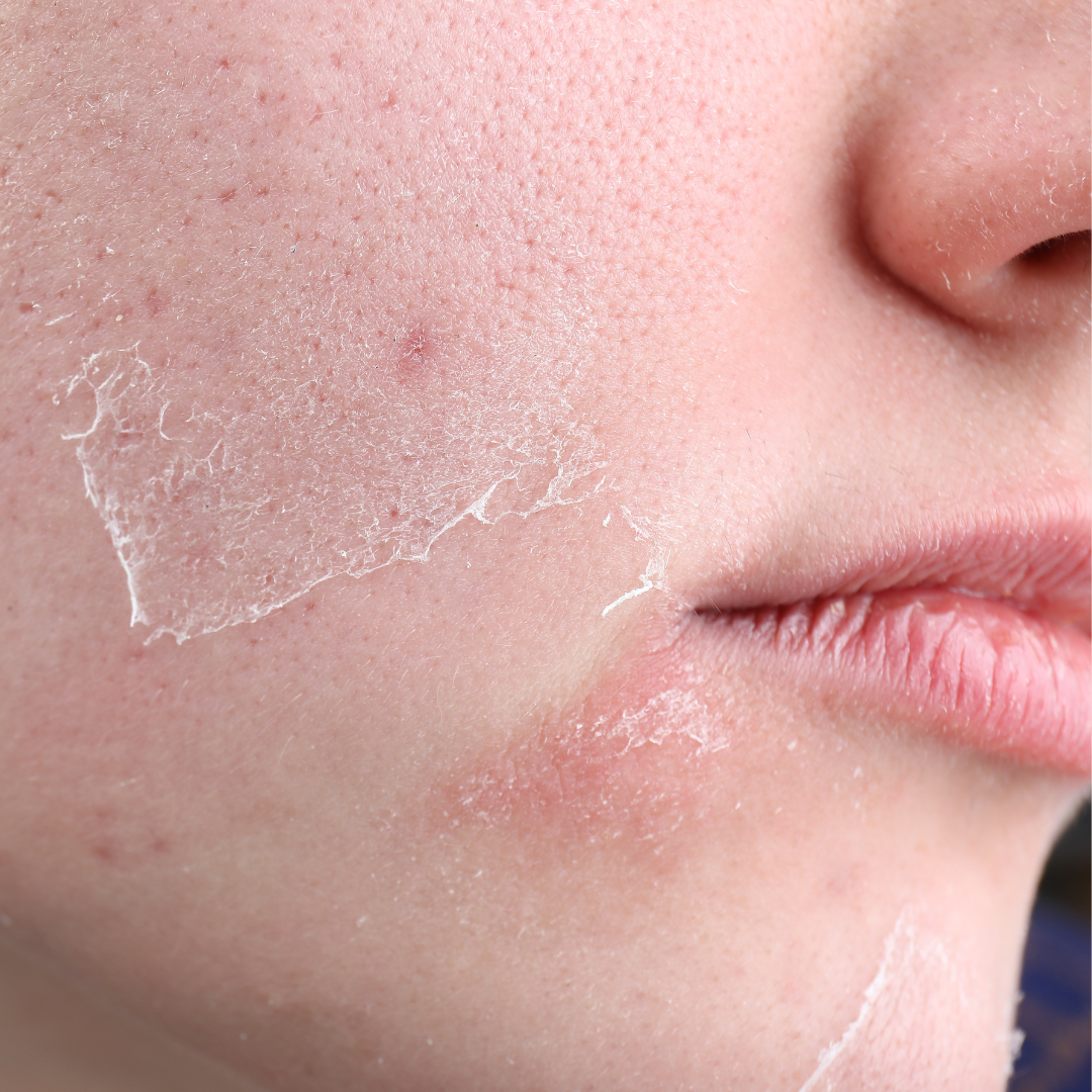 Rutina de Skincare para Piel Seca y Sensible (Noche)