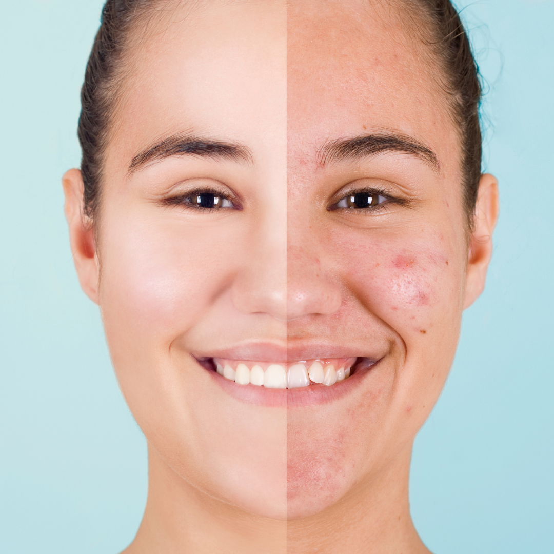 The Resurface & Hydrate Set